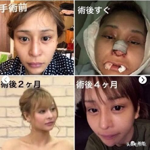 好听嘅日文名 女(日本整形界的"传奇"人物)-第27张图片-拓城游