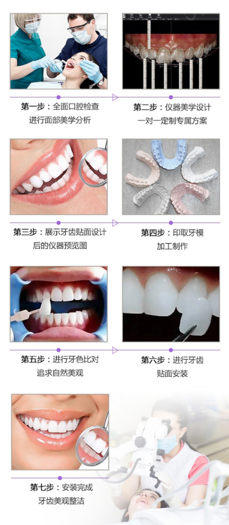 美伽汇充值没到账怎么办 (牙贴面:了解全瓷贴面修复的适应症及效果)-第3张图片-拓城游